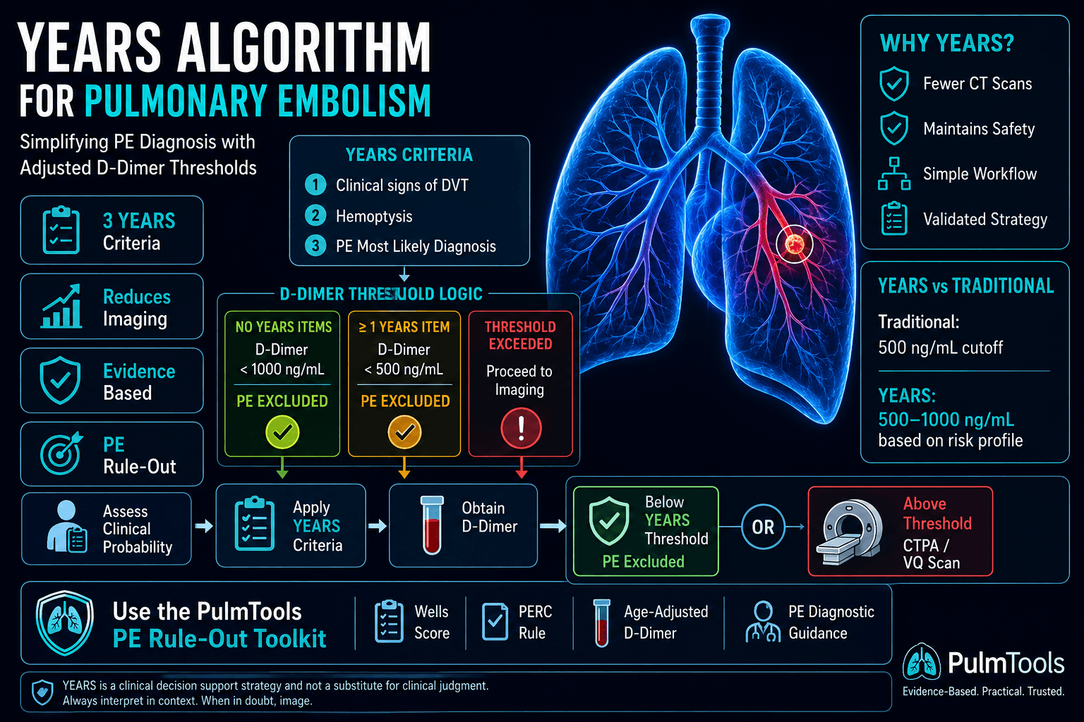 YEARS algorithm for pulmonary embolism infographic showing criteria, D-dimer thresholds, PE exclusion, and imaging pathways.
